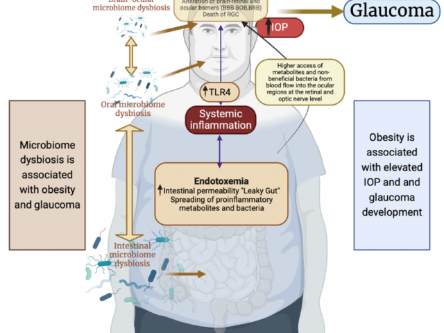 Lire la suite à propos de l’article Le lien entre le microbiote et le galucome – maladie oculaire caractérisée par des dommages progressifs du nerf optique